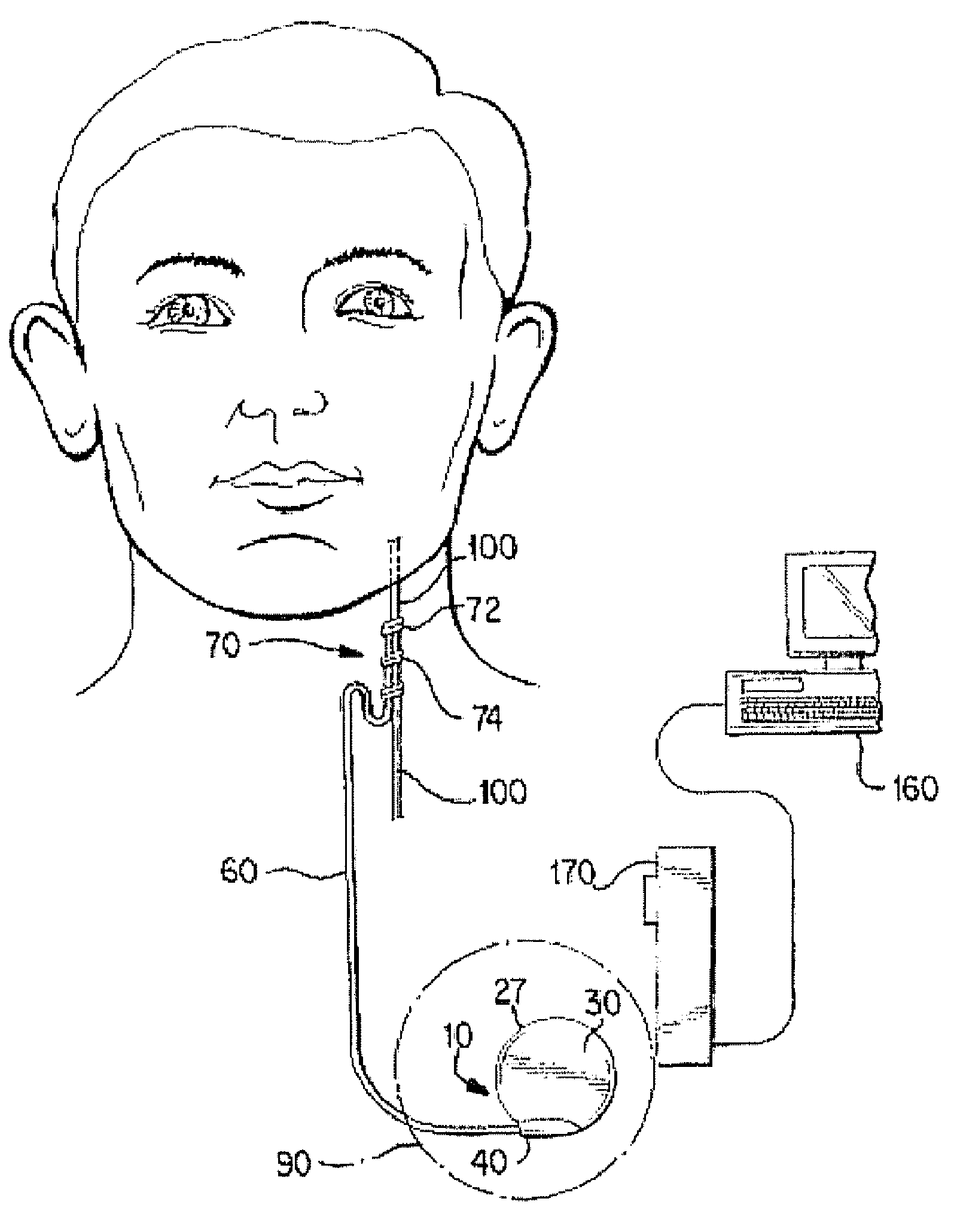 Vagus nerve stimulation by electrical signals for controlling cerebellar tremor