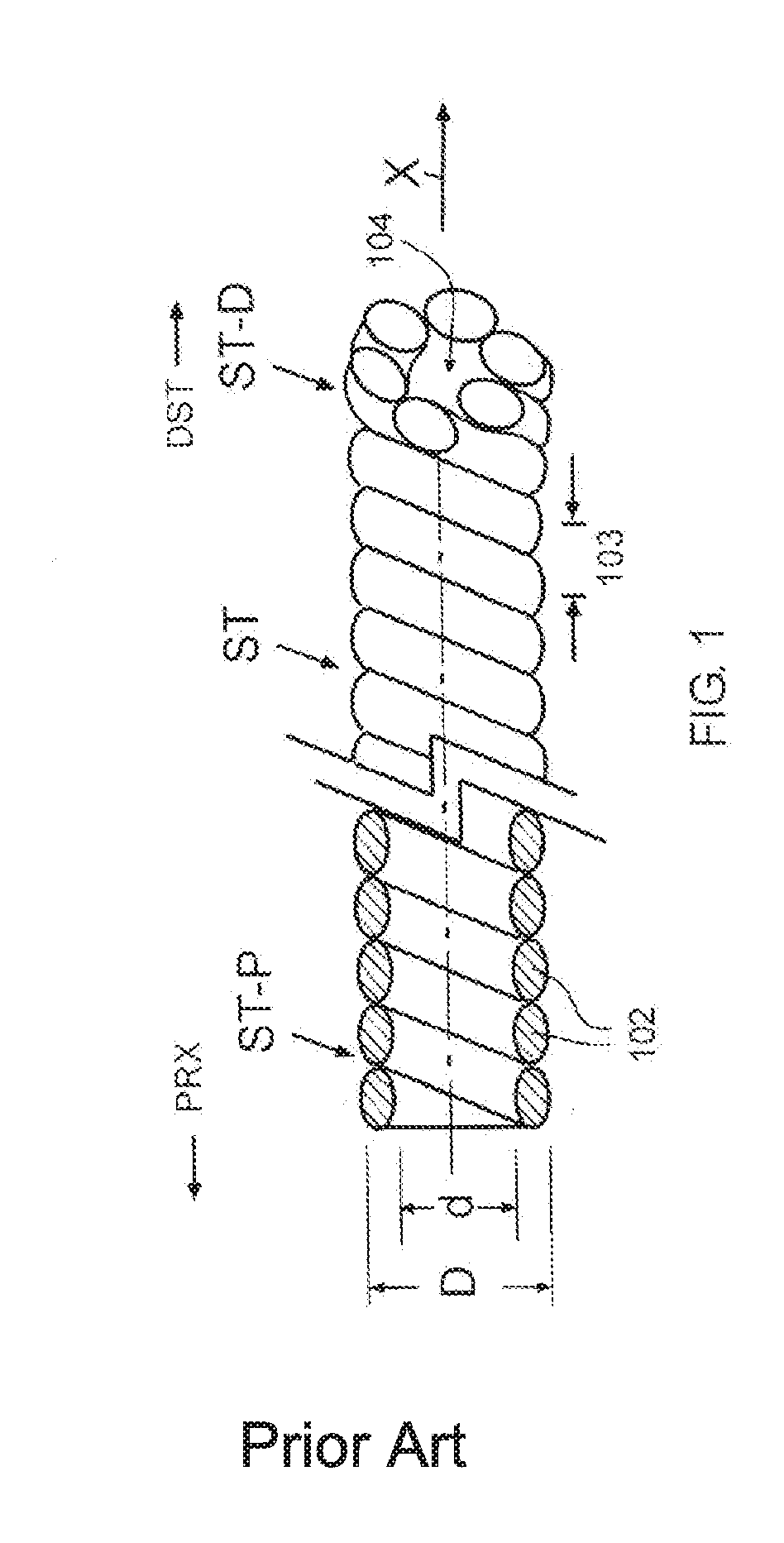 Method system and fastener for anchoring a corpu