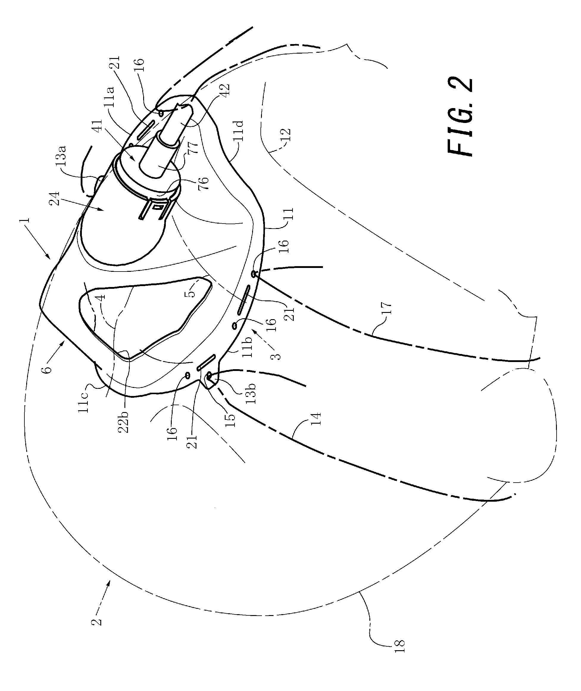 Gas supply mask apparatus