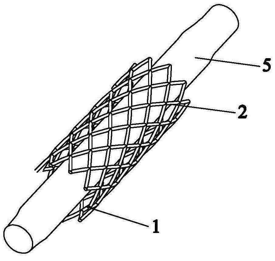 Expansible coronary stent provided with collagen tectorial membrane