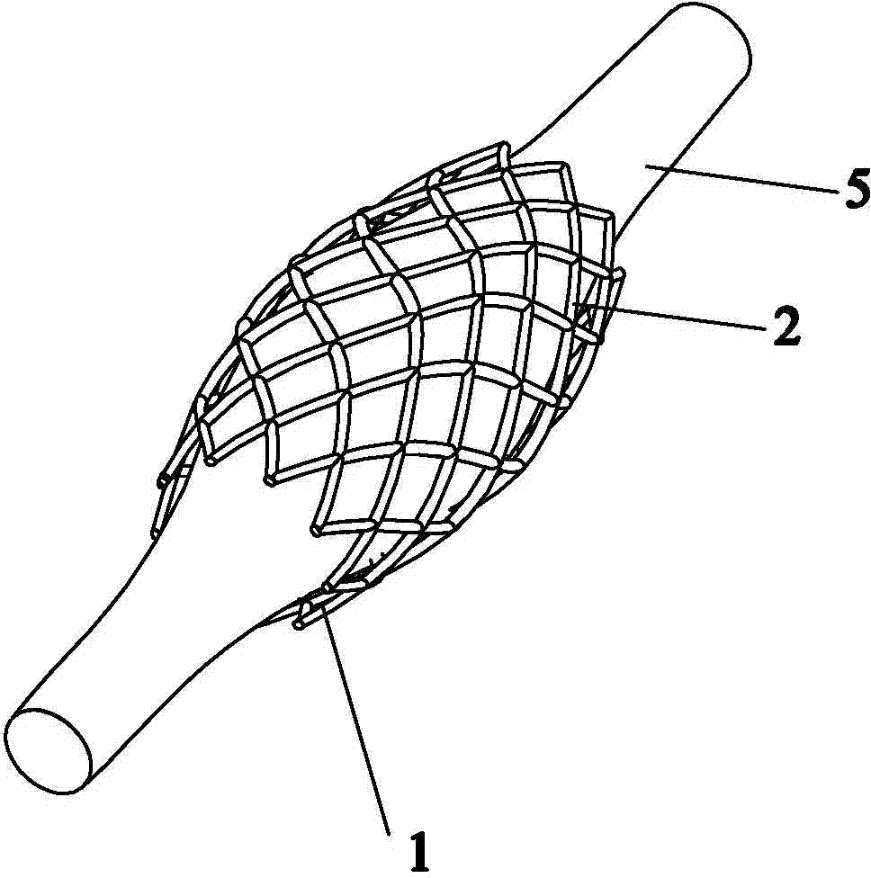 Expansible coronary stent provided with collagen tectorial membrane