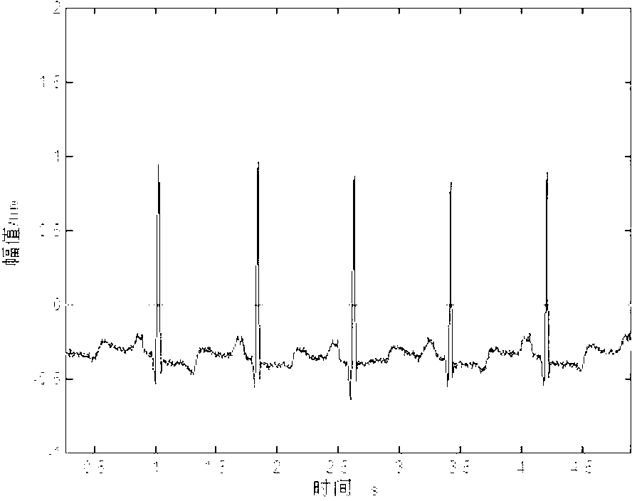 Detection method of electrocardiosignal R characteristic waves