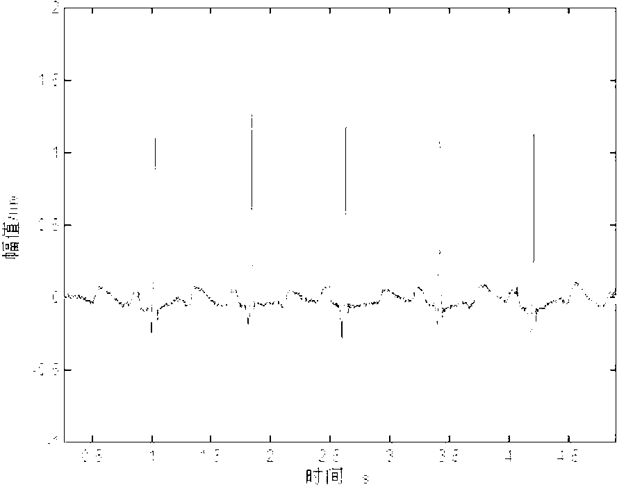 Detection method of electrocardiosignal R characteristic waves