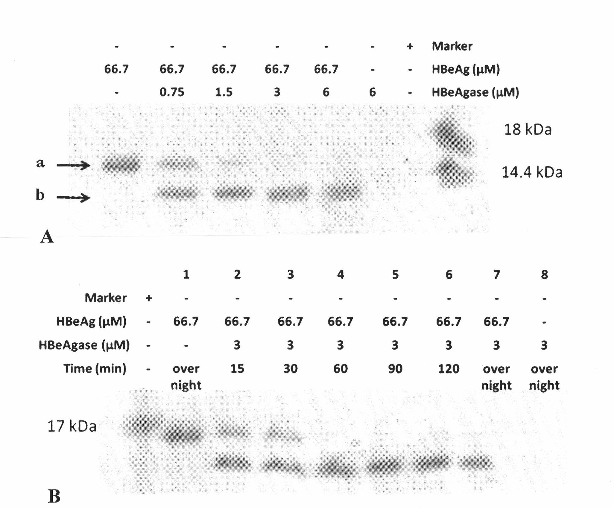 Earthworm protein with HBeAg degrading enzyme activity and application thereof