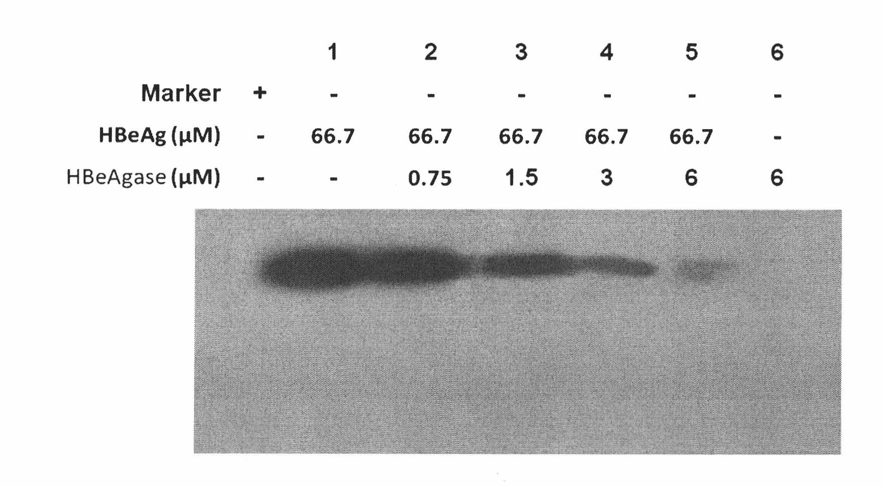 Earthworm protein with HBeAg degrading enzyme activity and application thereof