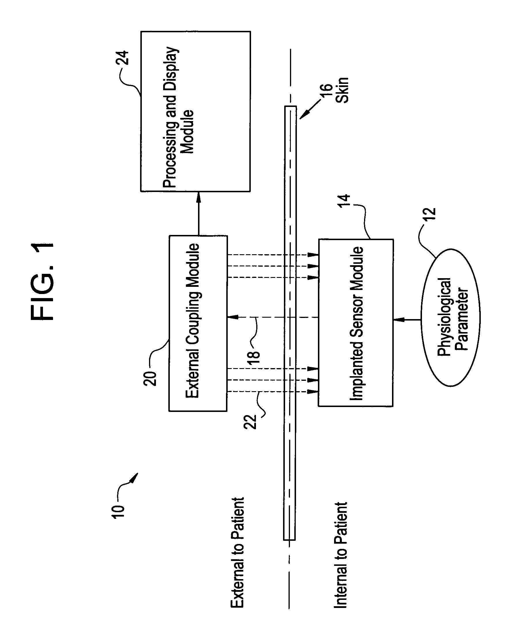 System for transcutaneous monitoring of intracranial pressure (ICP) using near infrared (NIR) telemetry