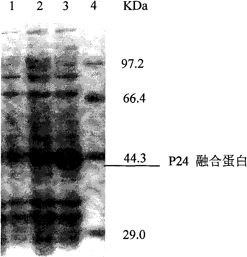 Monoclonal antibody hybridoma cell of HIV P24 and application