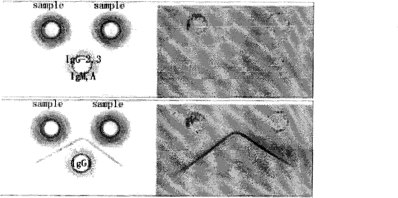 Monoclonal antibody hybridoma cell of HIV P24 and application