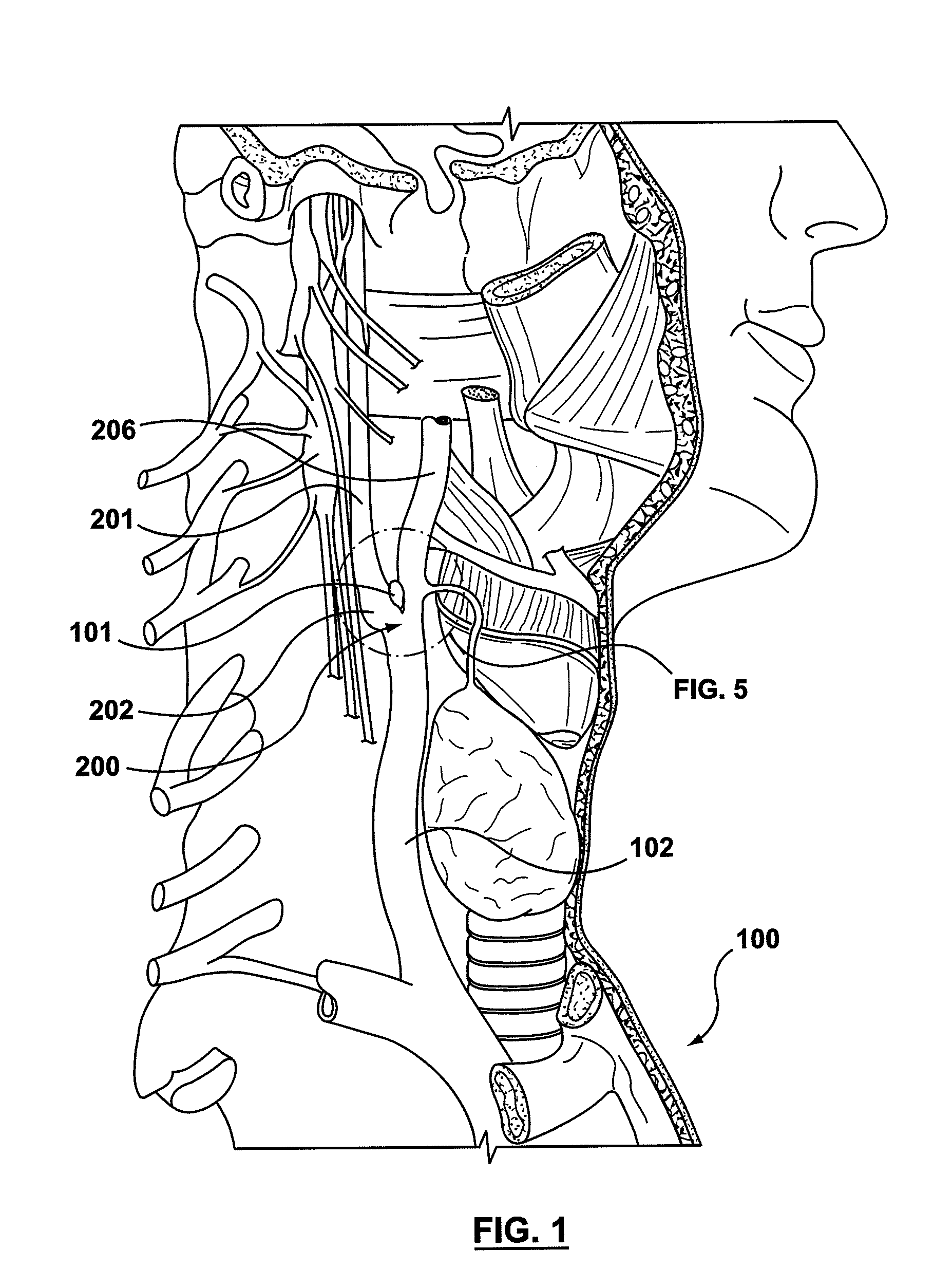 Carotid body modulation planning and assessment