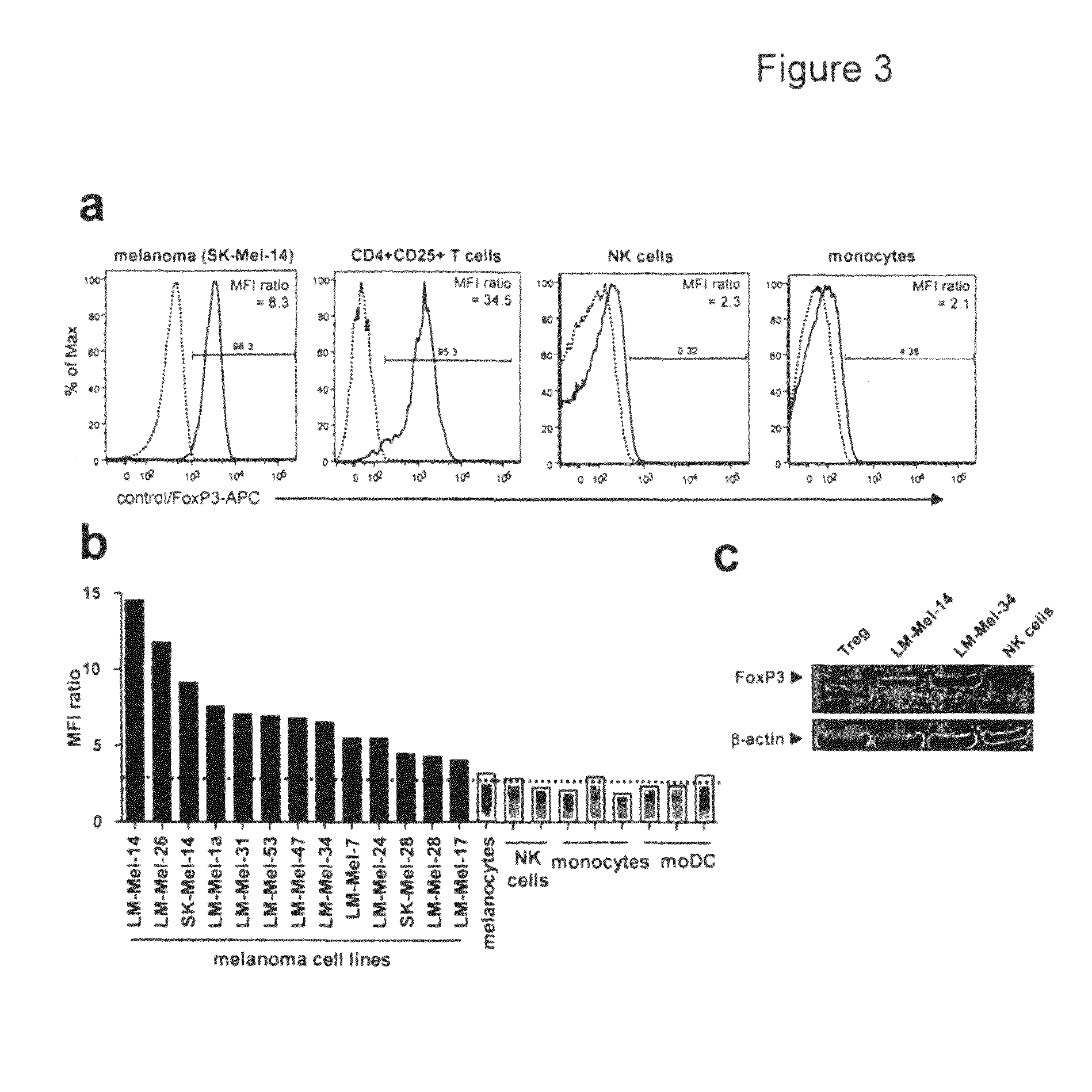 Expression of FoxP3 by cancer cells