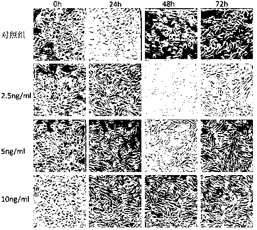 Screening method for proteinuria component induced renal interstitial fibrosis based on micro-fluidic chip