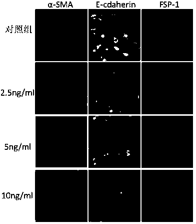 Screening method for proteinuria component induced renal interstitial fibrosis based on micro-fluidic chip