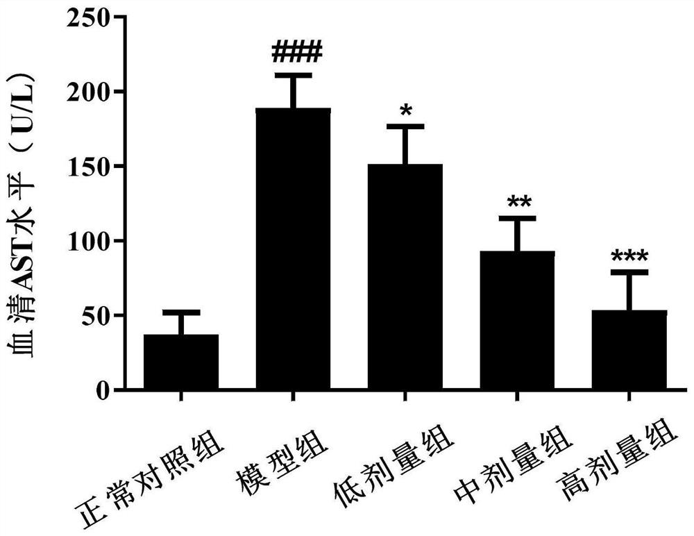 A kind of traditional Chinese medicine compound preparation for treating liver fibrosis and its preparation method and application