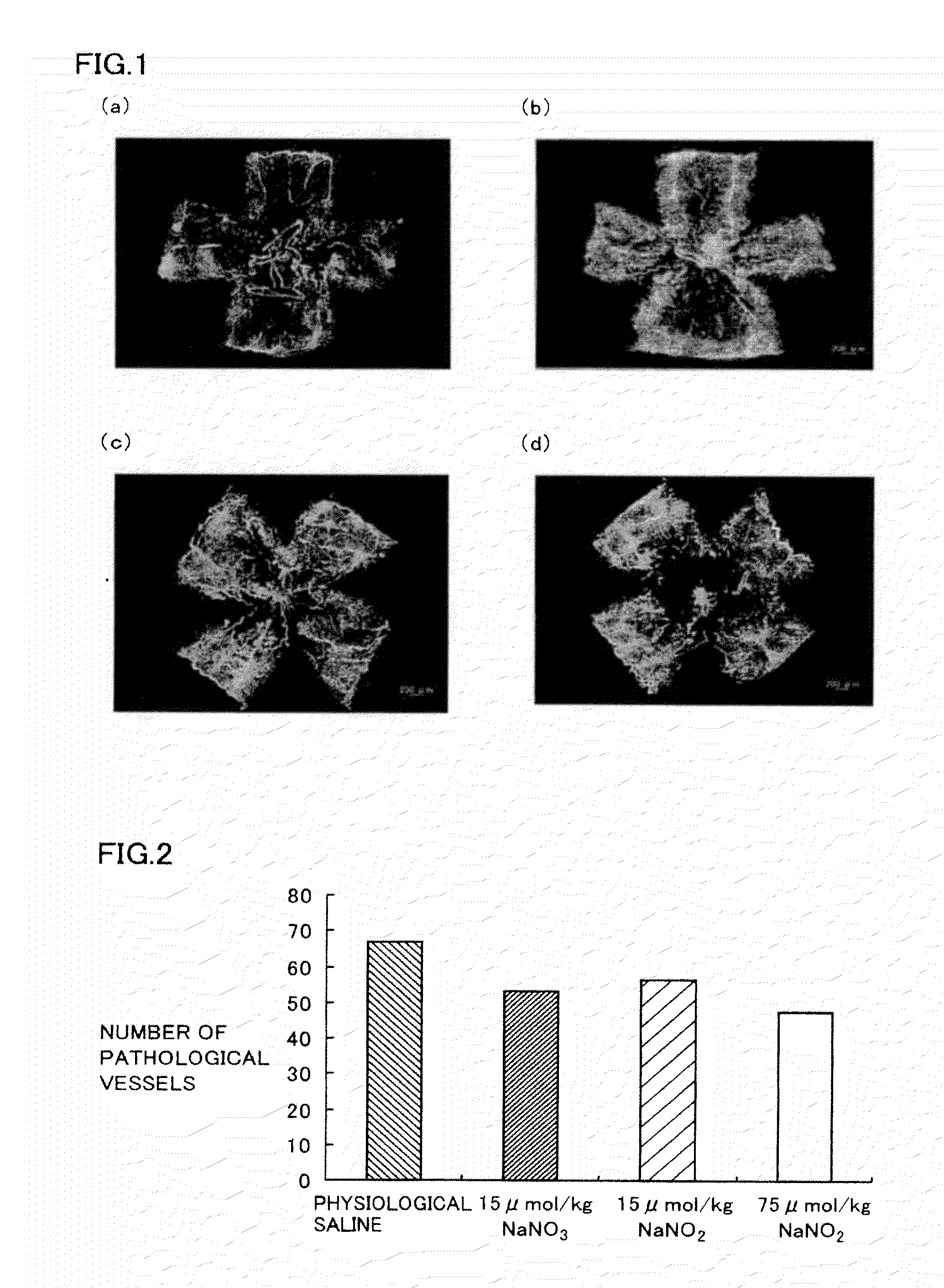 Angiogenesis regulating composition and method for regulating angiogenesis