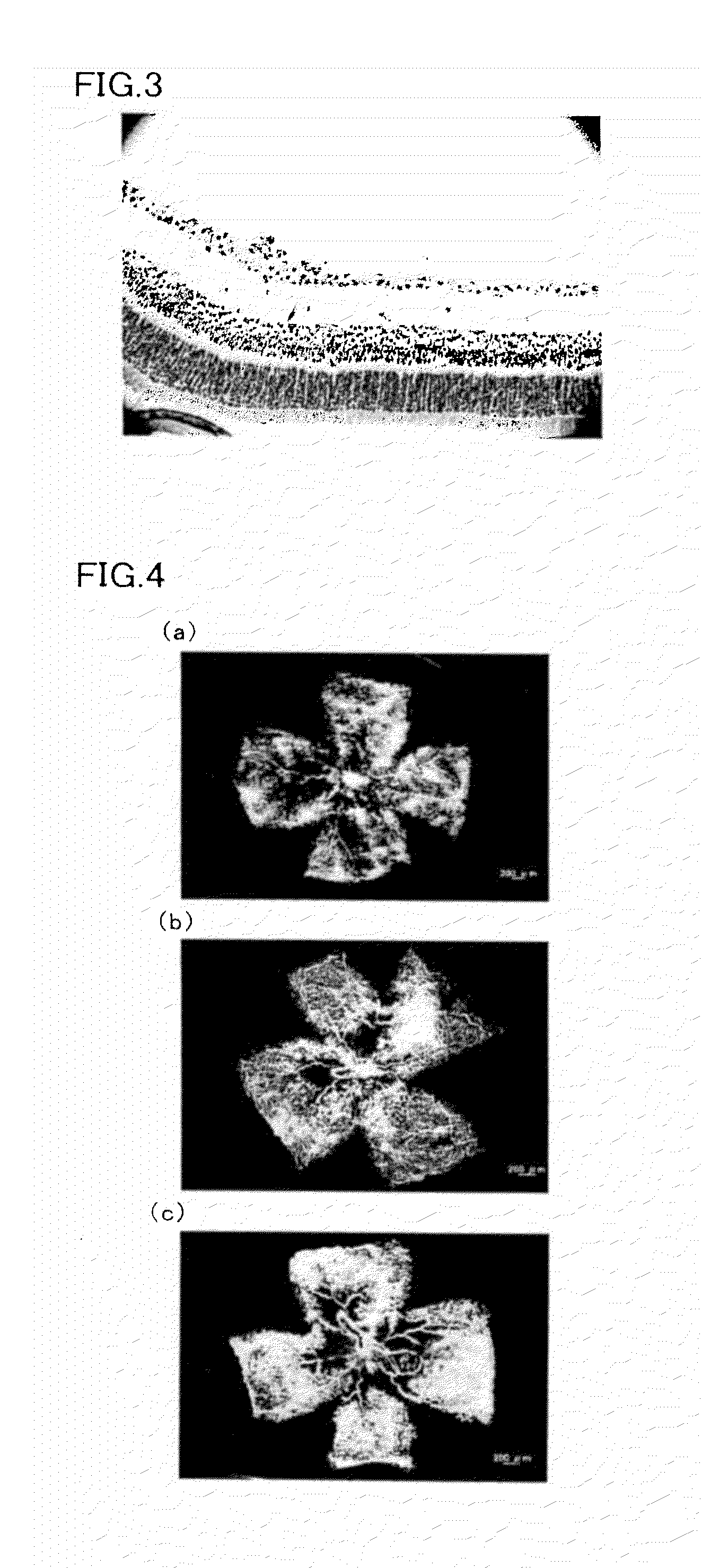 Angiogenesis regulating composition and method for regulating angiogenesis