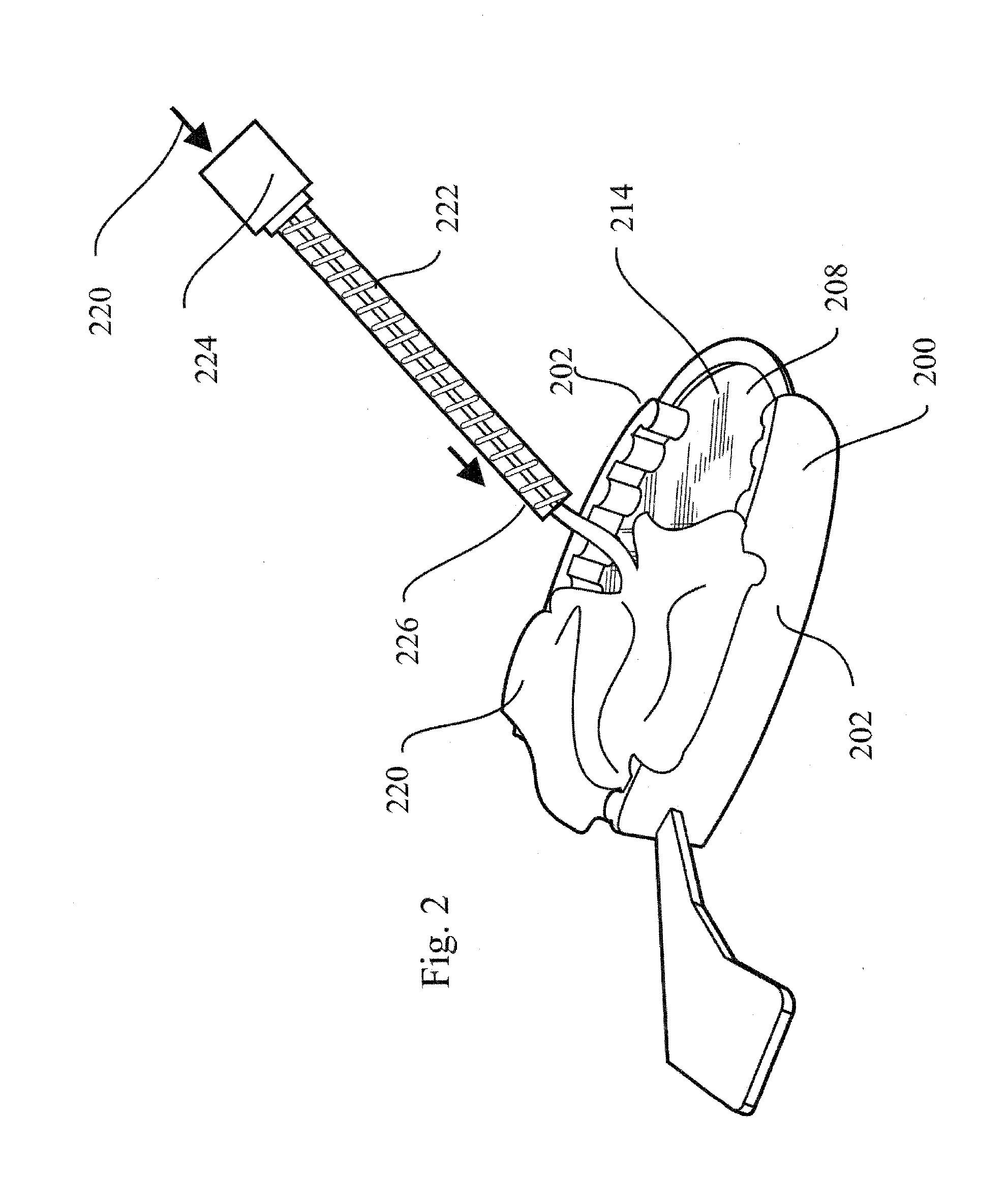 Method and system of making dental impressions