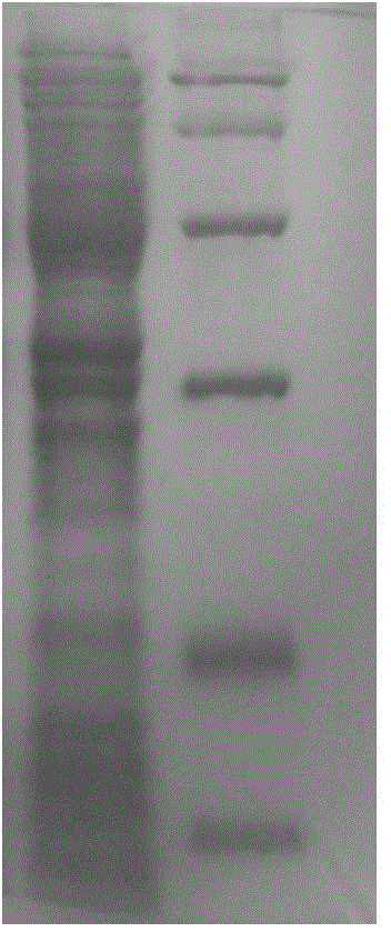 Immobilized monoamine oxidase and application thereof in synthesis of chiral azabicyclic compound