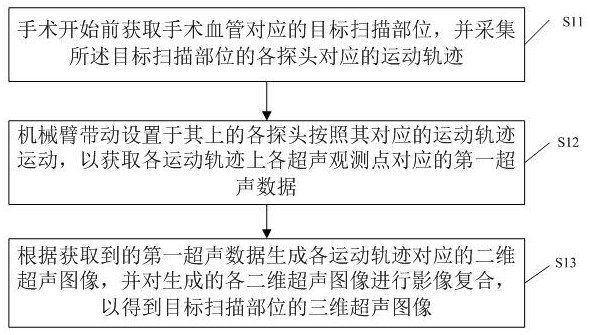 Ultrasonic navigation method and equipment for vascular operation