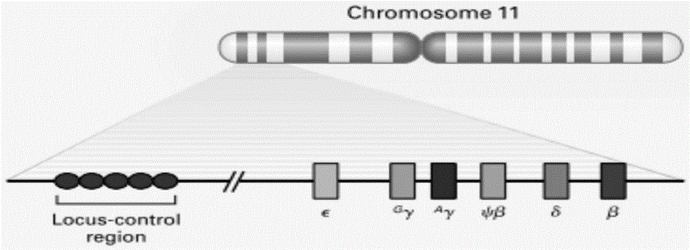 Reagent kit for detecting HBB gene mutation and HLA genotyping