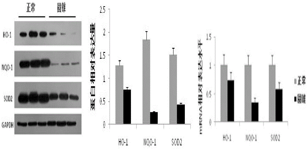 Medicine for treating keratoconus