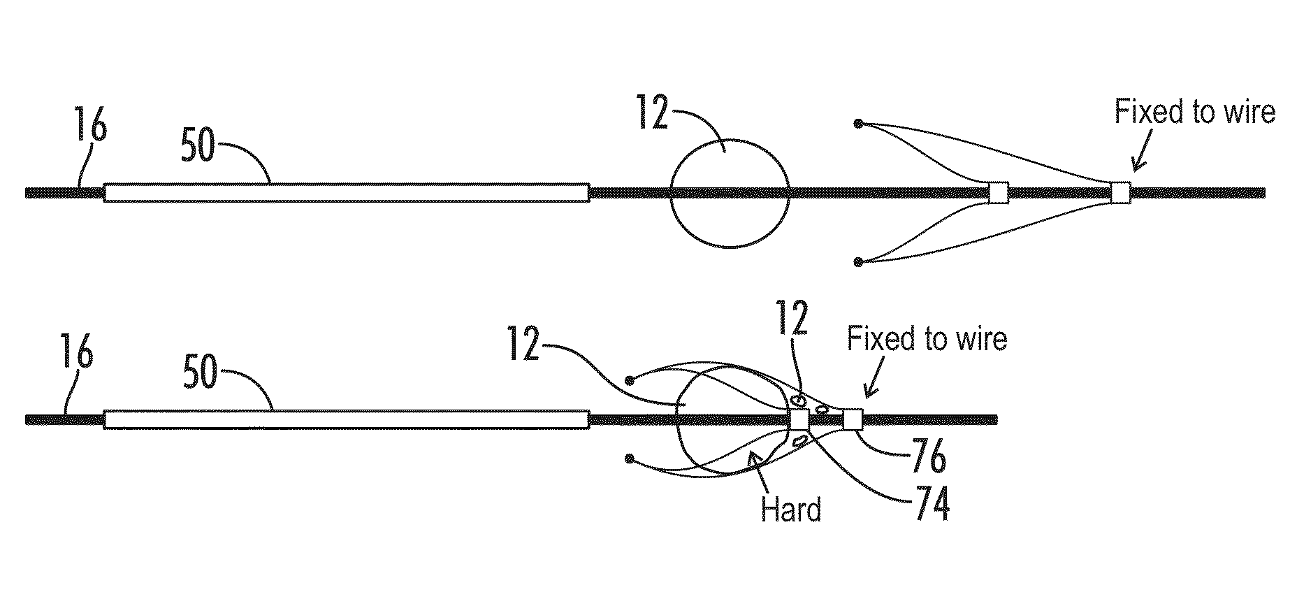 Clot retrieval system