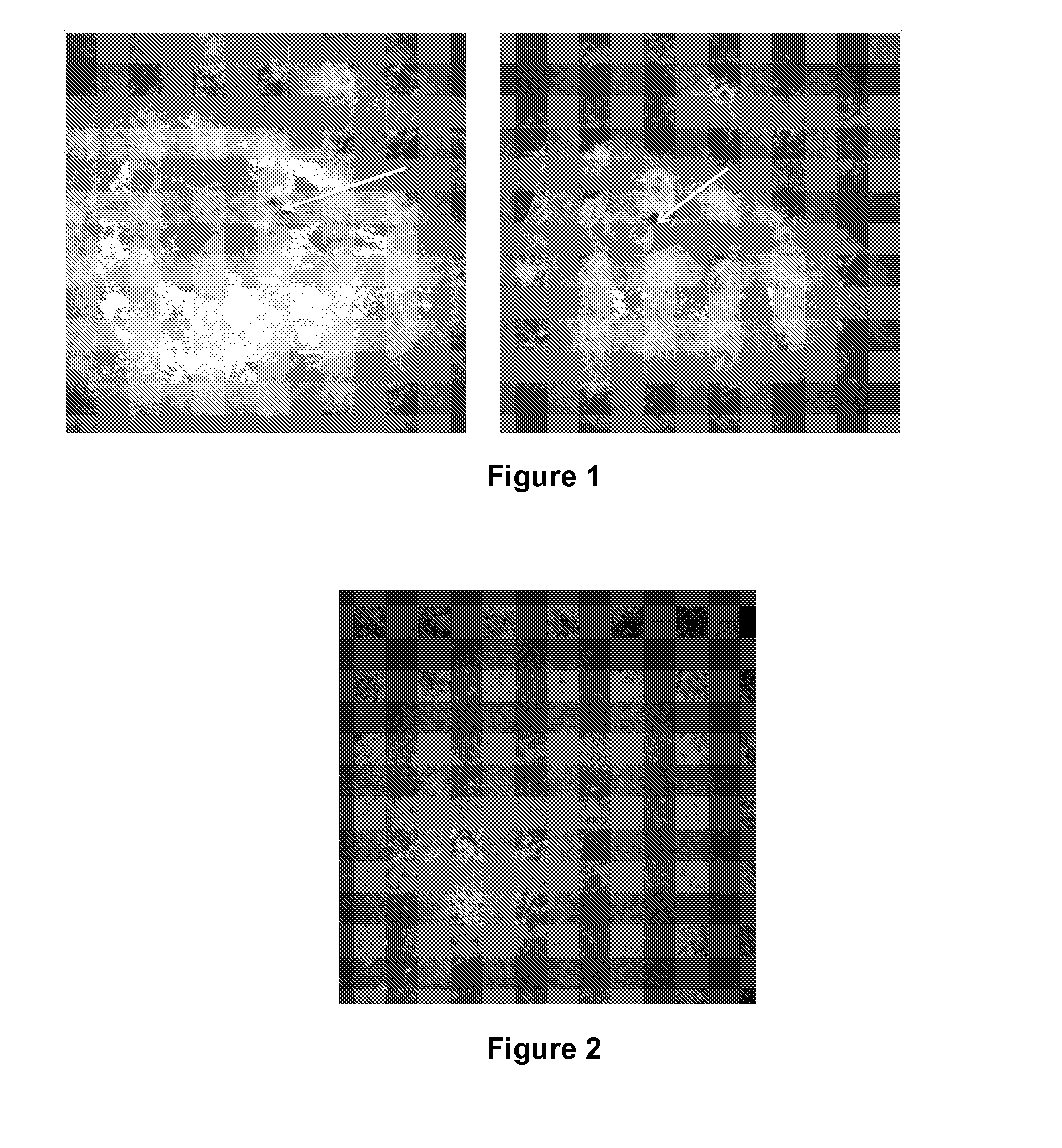 Inflammatory eye disorders