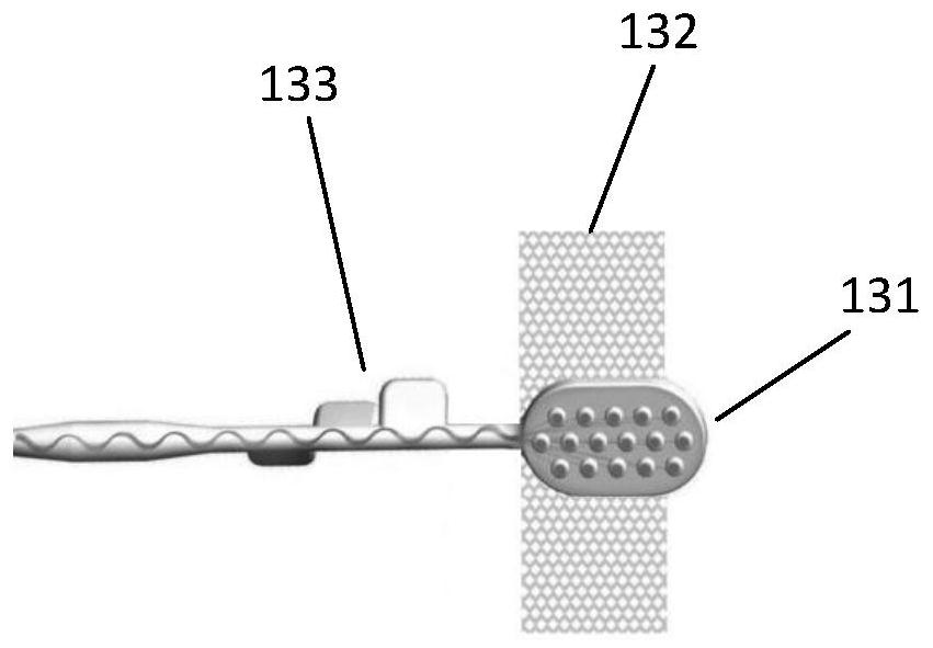 An artificial auditory brainstem stimulator