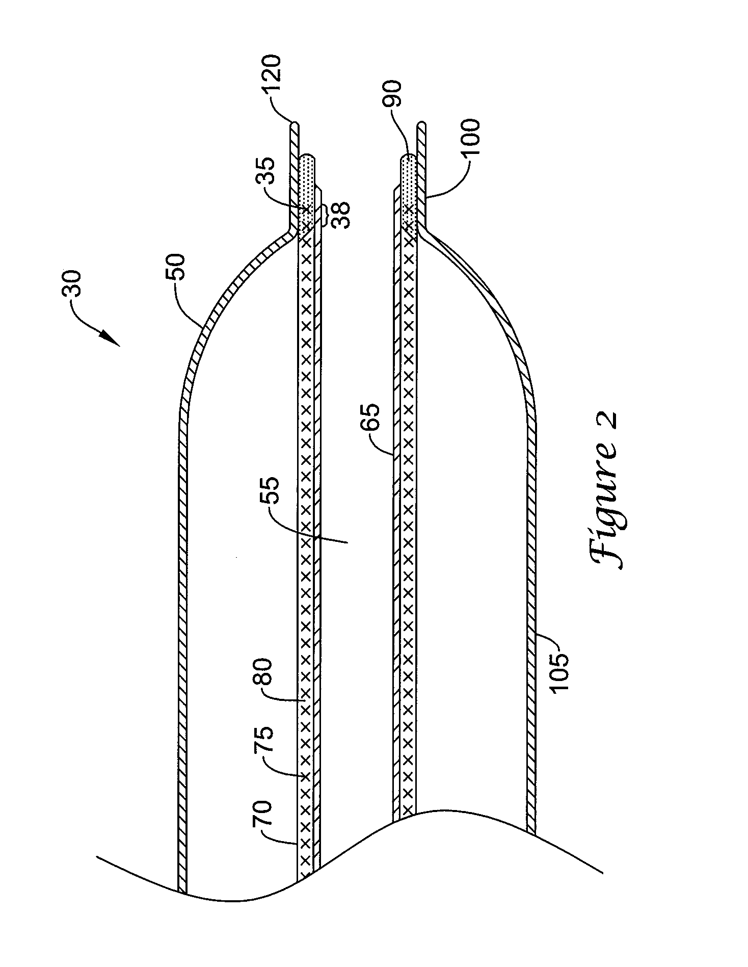 Catheter Having an Ultra Soft Tip and Methods for Making the Same