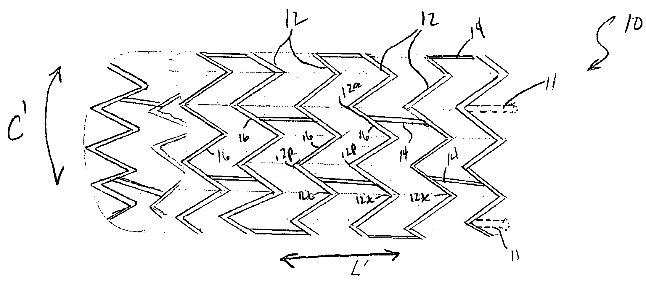 Endoluminal stent having mid-strut interconnecting members