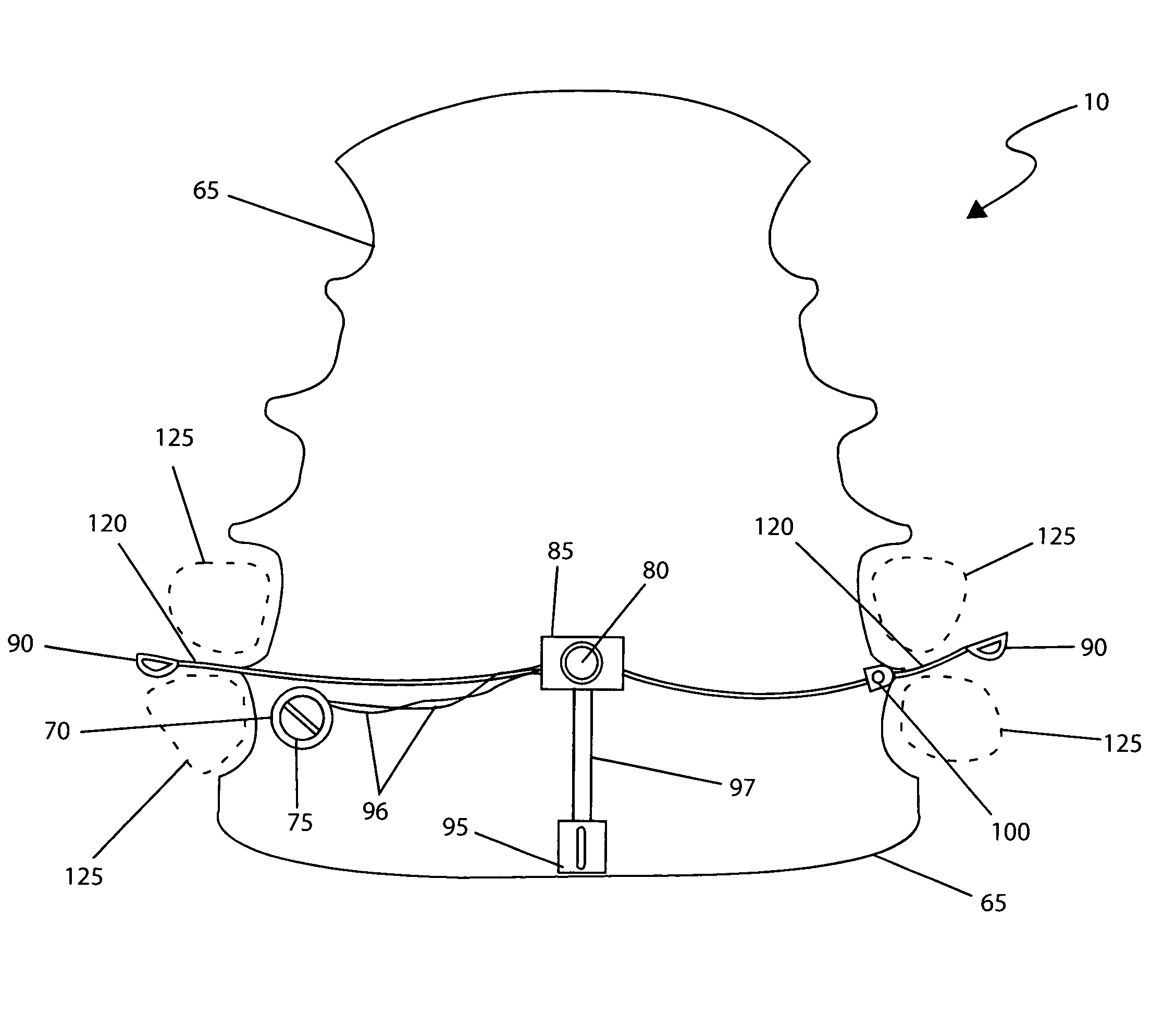 Oral hearing aid device and method of use thereof