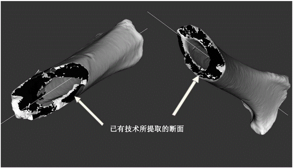 Principal vector analysis based broken bone section segmentation and broken bone model registration method