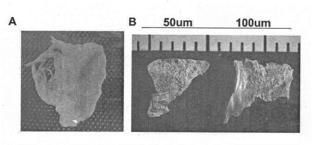 Acellular matrix of human heart valve tissue and preparation and application of acellular matrix