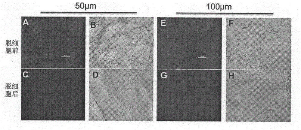 Acellular matrix of human heart valve tissue and preparation and application of acellular matrix