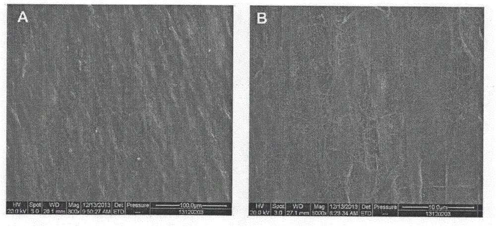 Acellular matrix of human heart valve tissue and preparation and application of acellular matrix