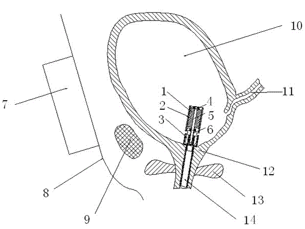 In-vitro alternating magnetic field driven bladder urination pump