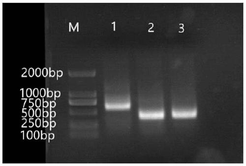 CD22 single domain antibody, nucleotide sequence, reagent kit, CAR-T virus vector and CAR-T cell