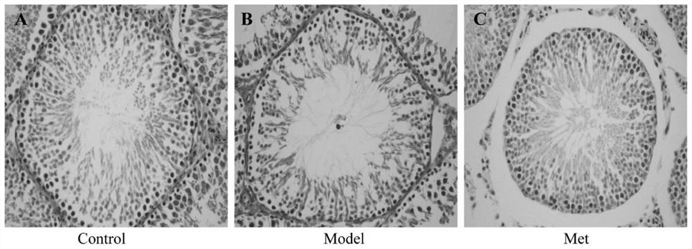 Application of metformin in preparation of medicine for treating testicular function decline