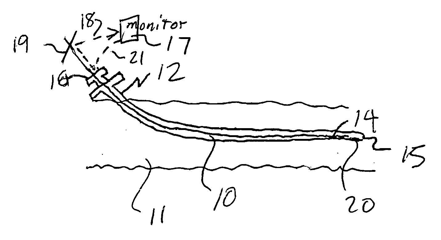 Endovascular method and apparatus with electrical feedback