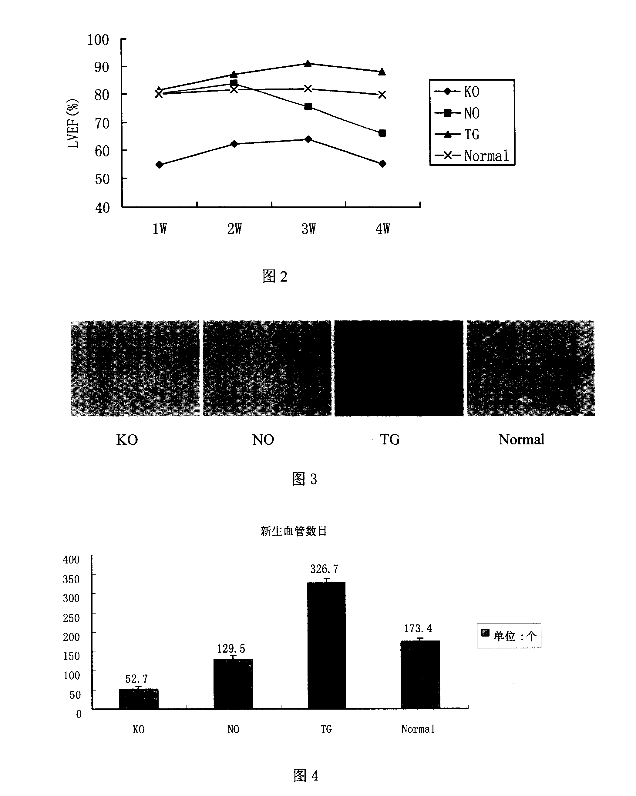 Human myocardium protecting gene and uses thereof