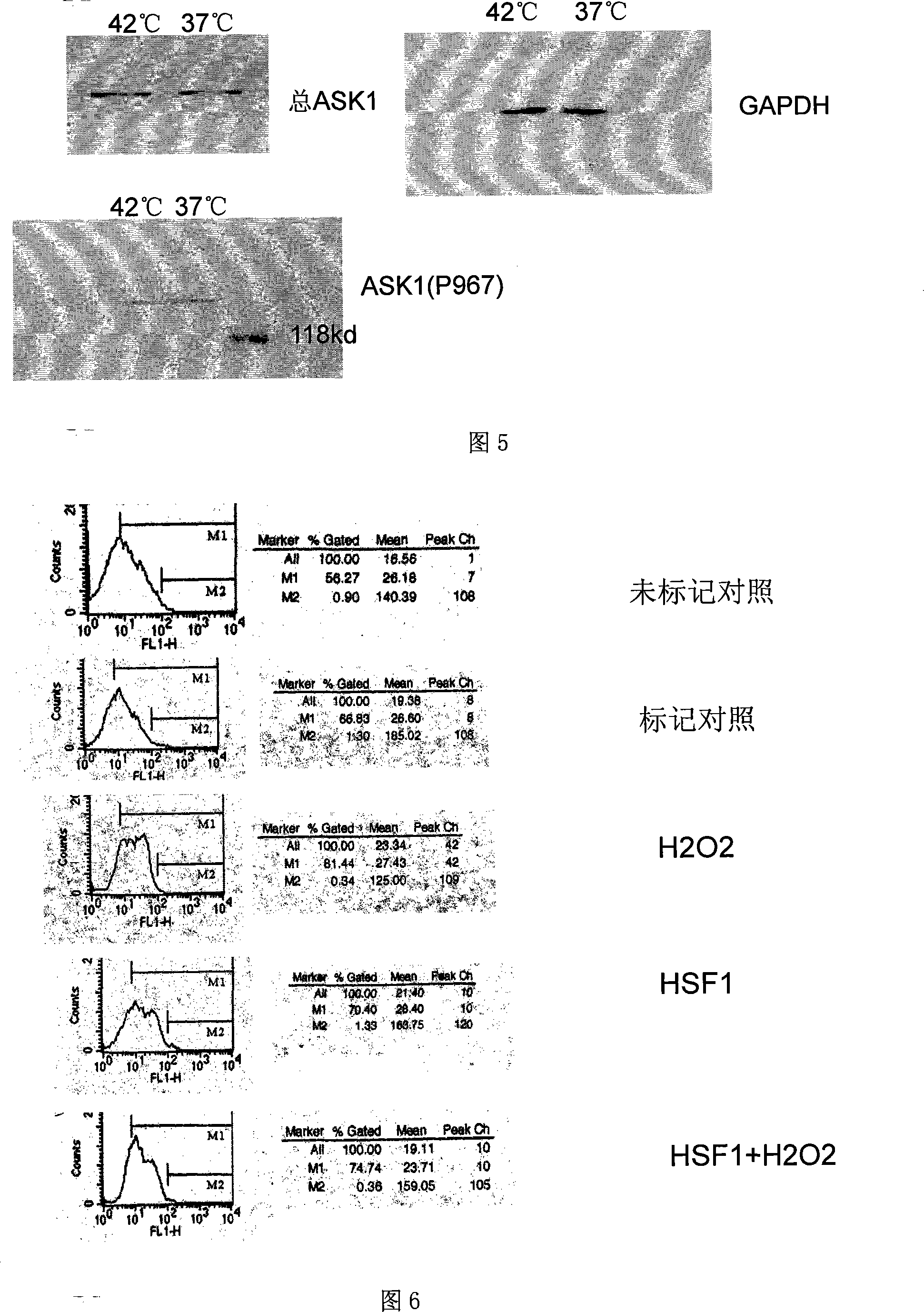 Human myocardium protecting gene and uses thereof