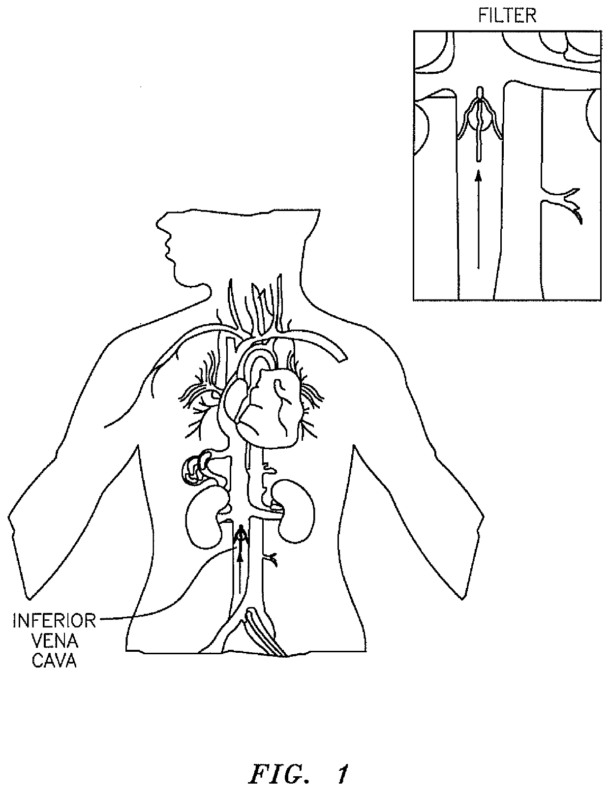 Inferior vena cava filter retrieval device and method of retrieving same