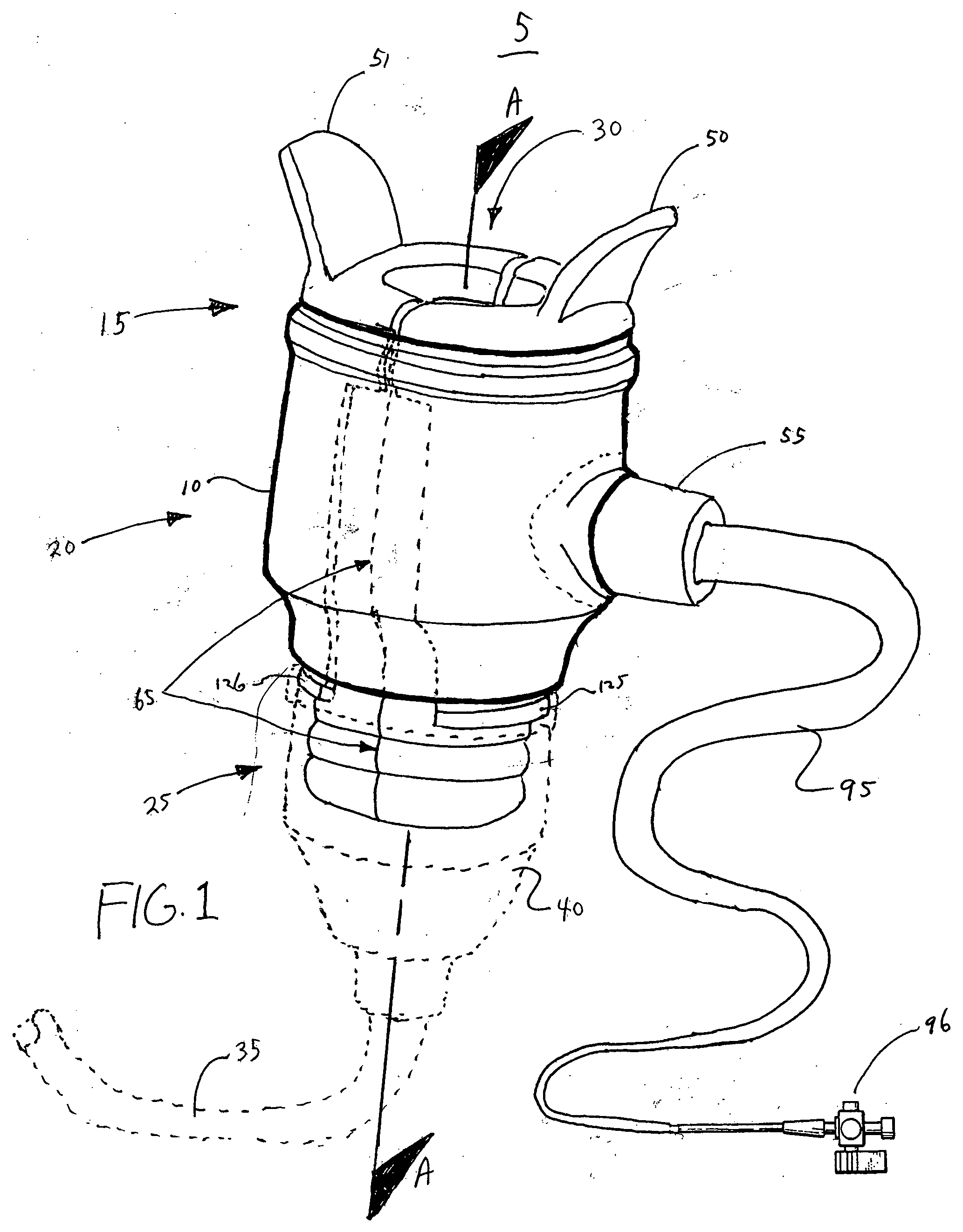 Splittable hemostasis valve