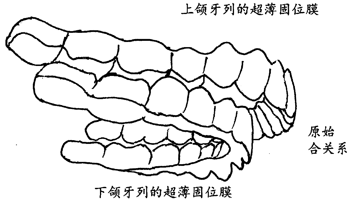 Manufacturing method and application of pressed film material functional appliance