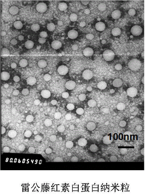 Glomerulus-targeted protein nanoparticle pharmaceutical composition and application thereof