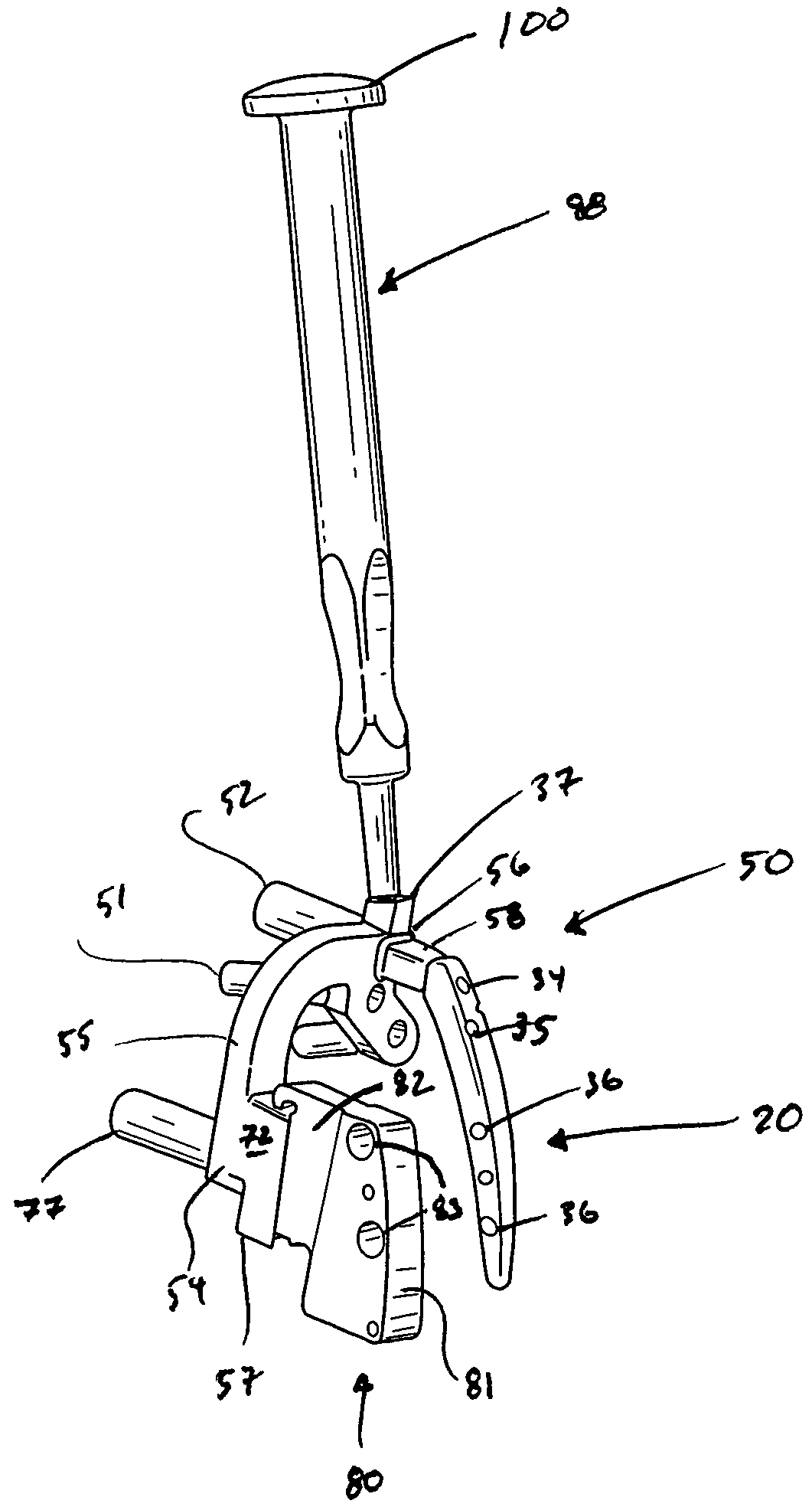 Guide assembly for intramedullary fixation and method of using the same