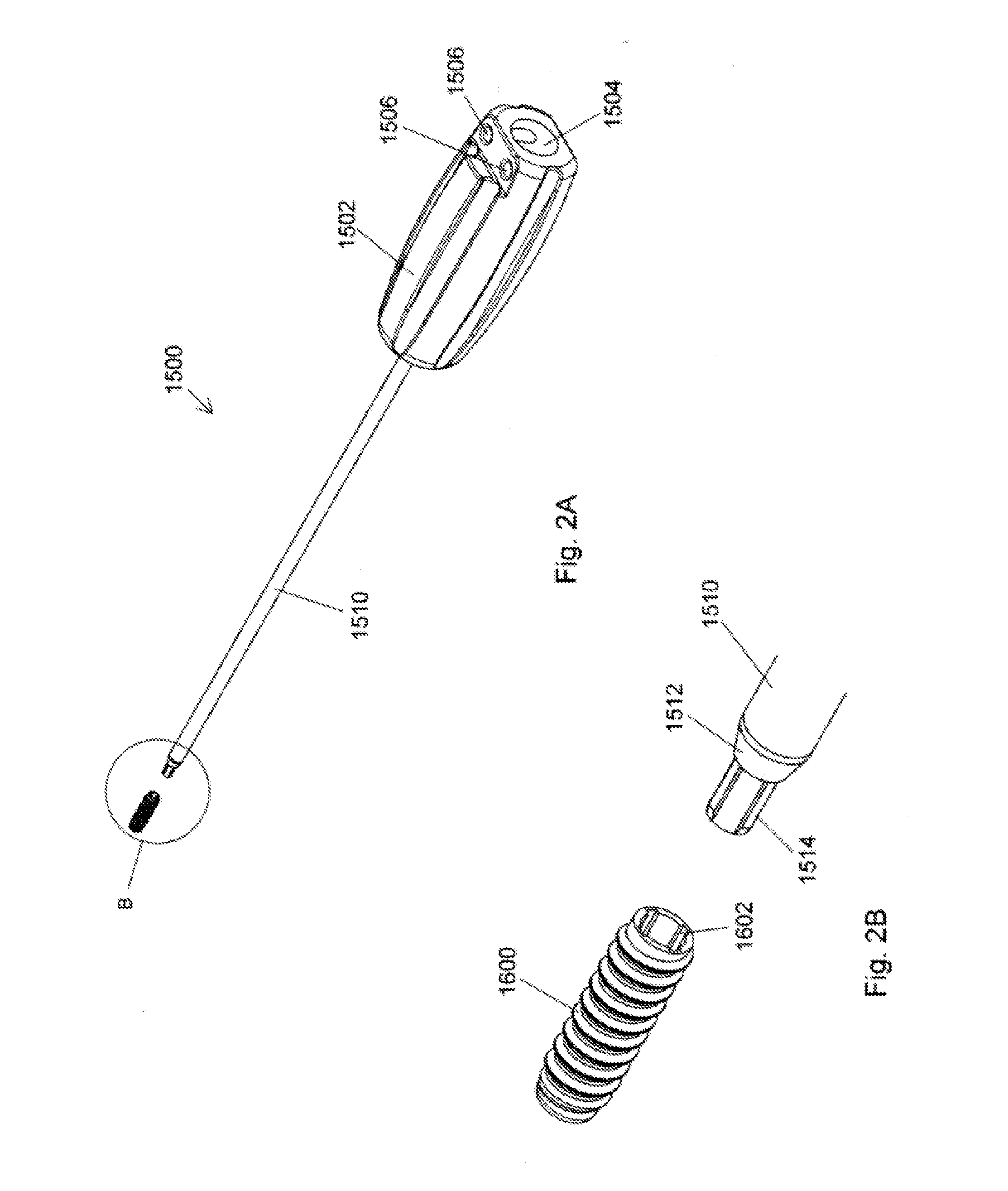 Ceramic implant placement systems and superelastic suture retention loops for use therewith