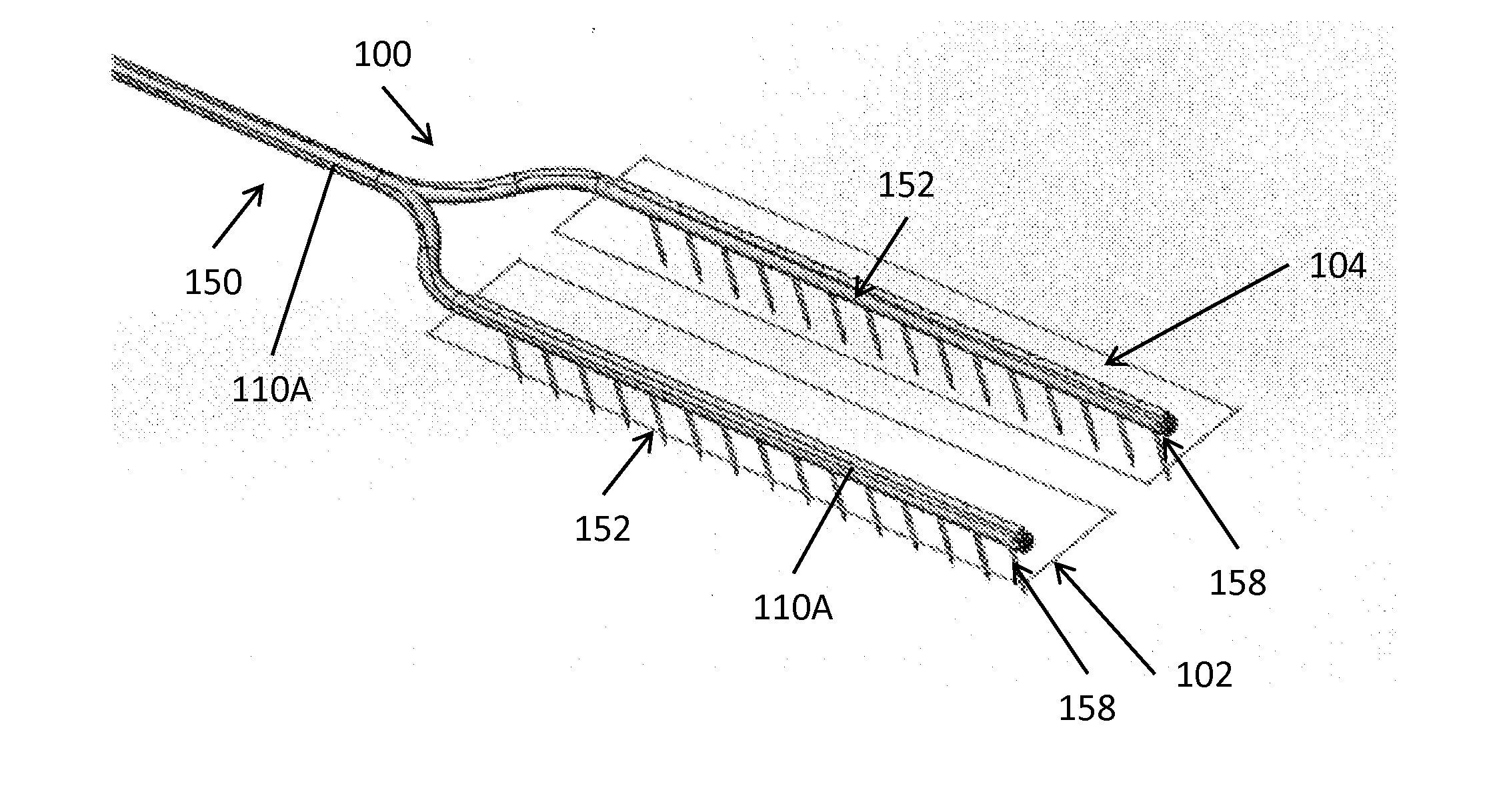 Rapid closing surgical closure device