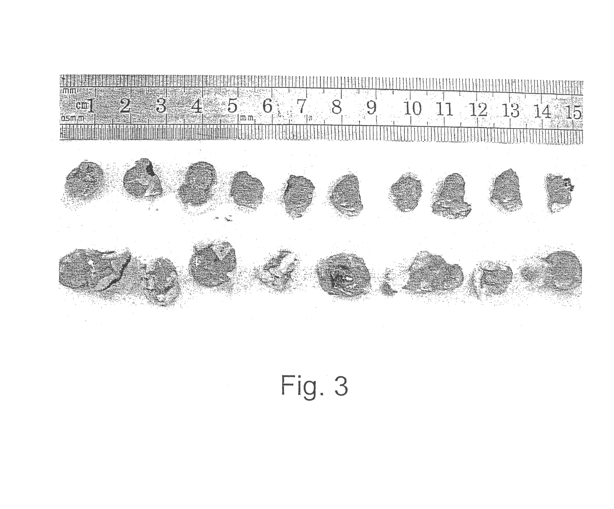 Methods and uses of leptin in hepatocellular carcinoma