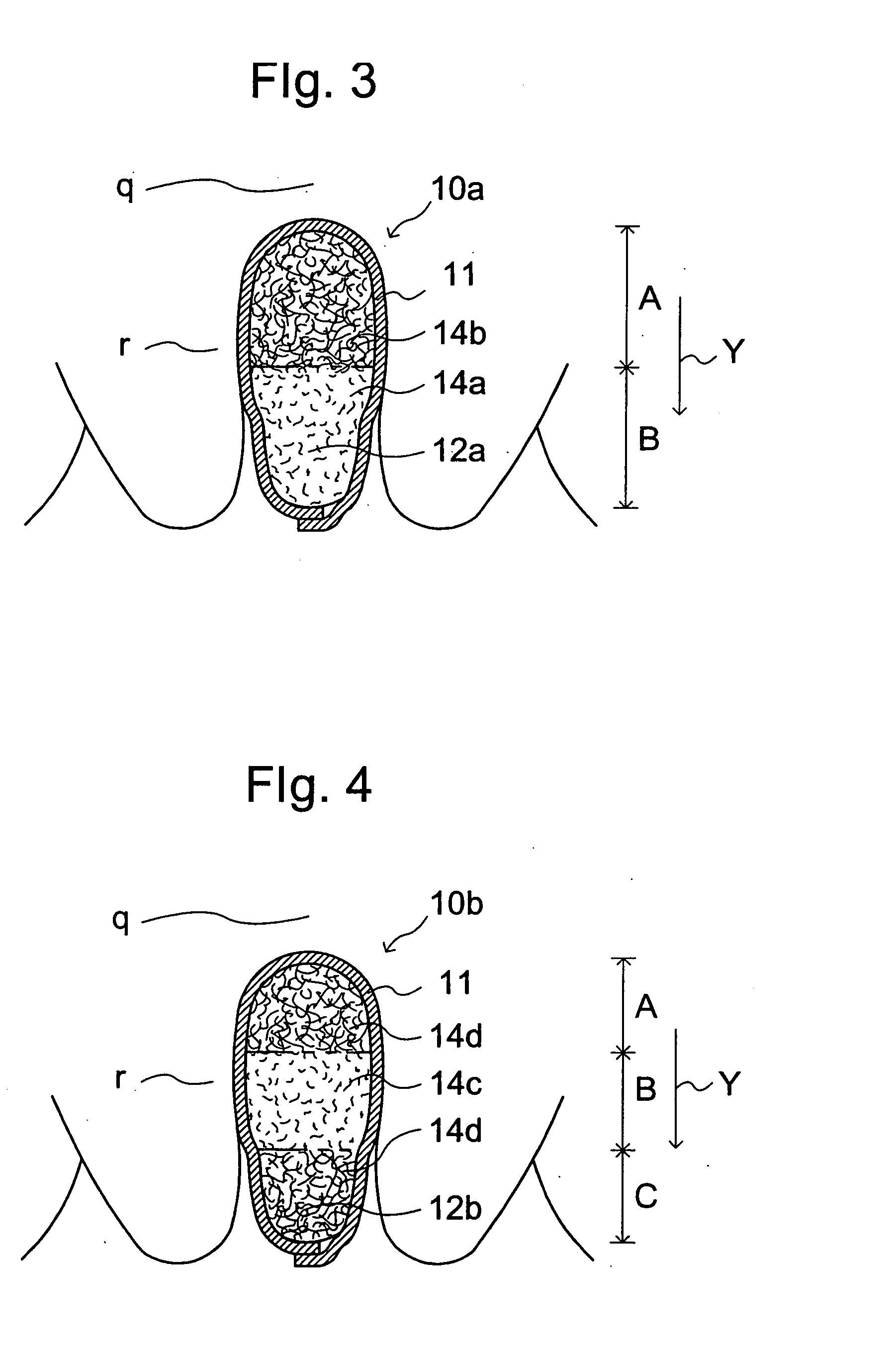 Interlabial pad