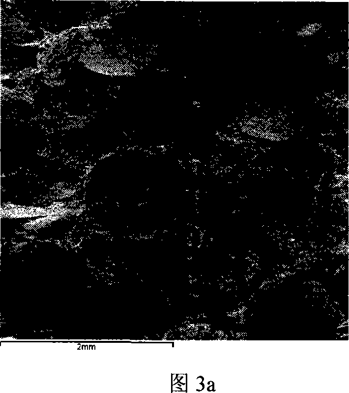 Preparation method of ceramic-metal composite material